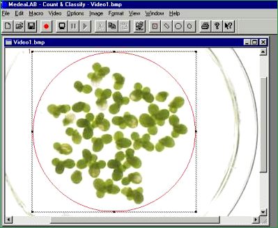 medeaLAB Count & Classify