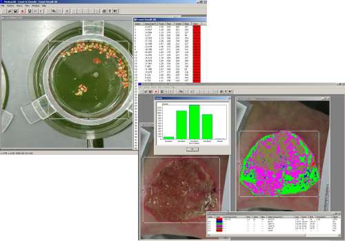 Classification of Lemna leafs and tissue